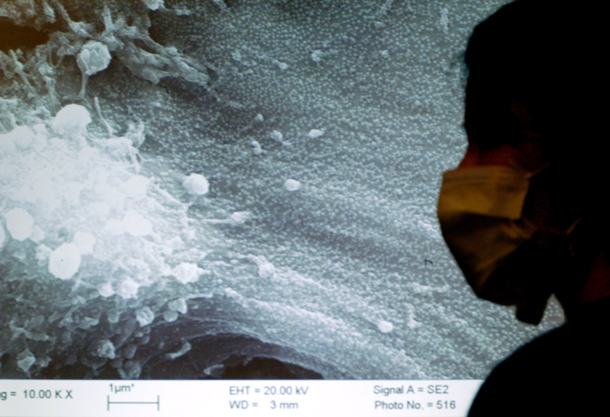A reporter sits in front a projected image showing Sars-infected cells inspected under a microscope during a news conference in Hong Kong in 2003. The new coronavirus is similar to the one that caused Sars, but they are not identical. Photo: Reuters
