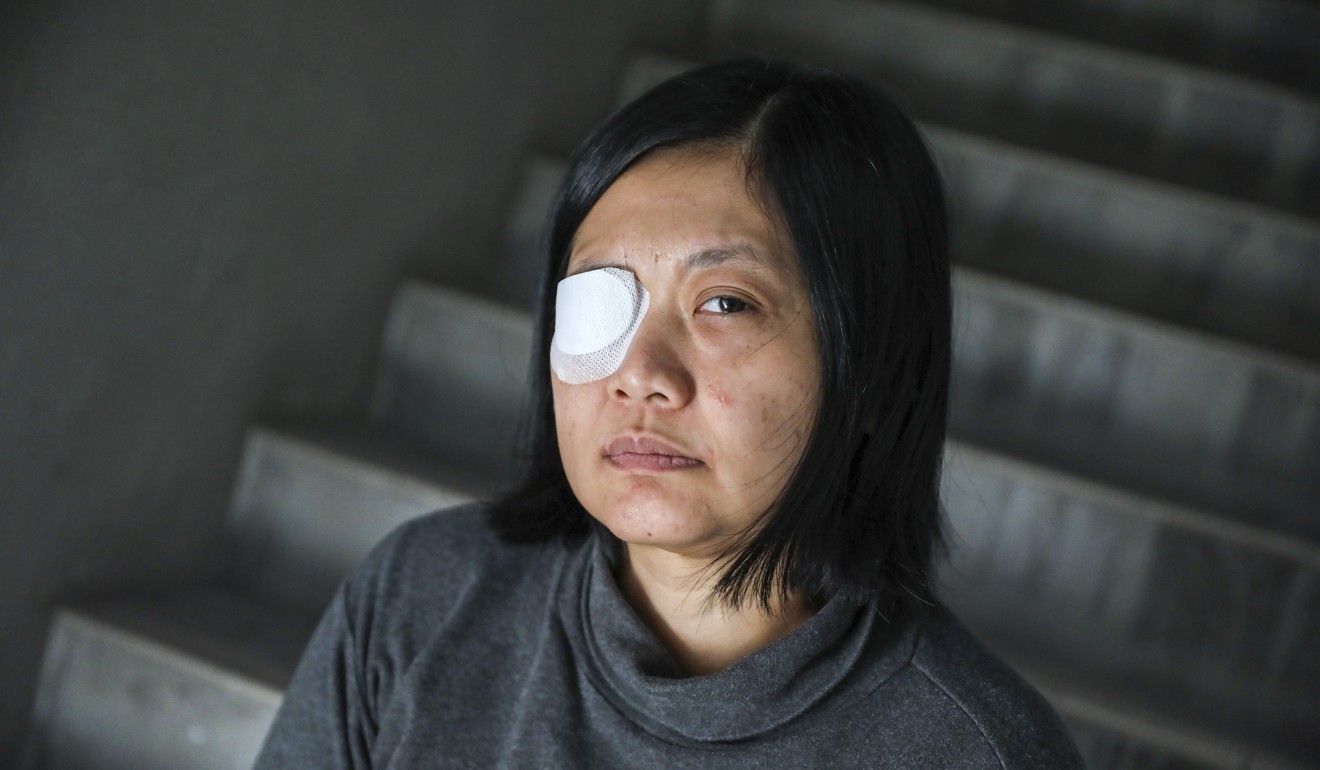 Indonesian journalist Veby Mega Indah was left blind in one eye after being shot during a protest in September. Photo: K.Y. Cheng