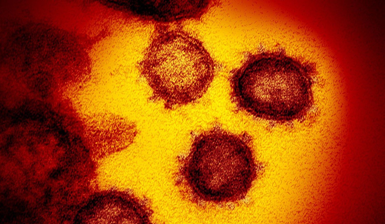 Doctor Jain Doctor Vijay Sexy Video Xxx Downloading - Coronavirus: pathogen could have been spreading in humans for ...