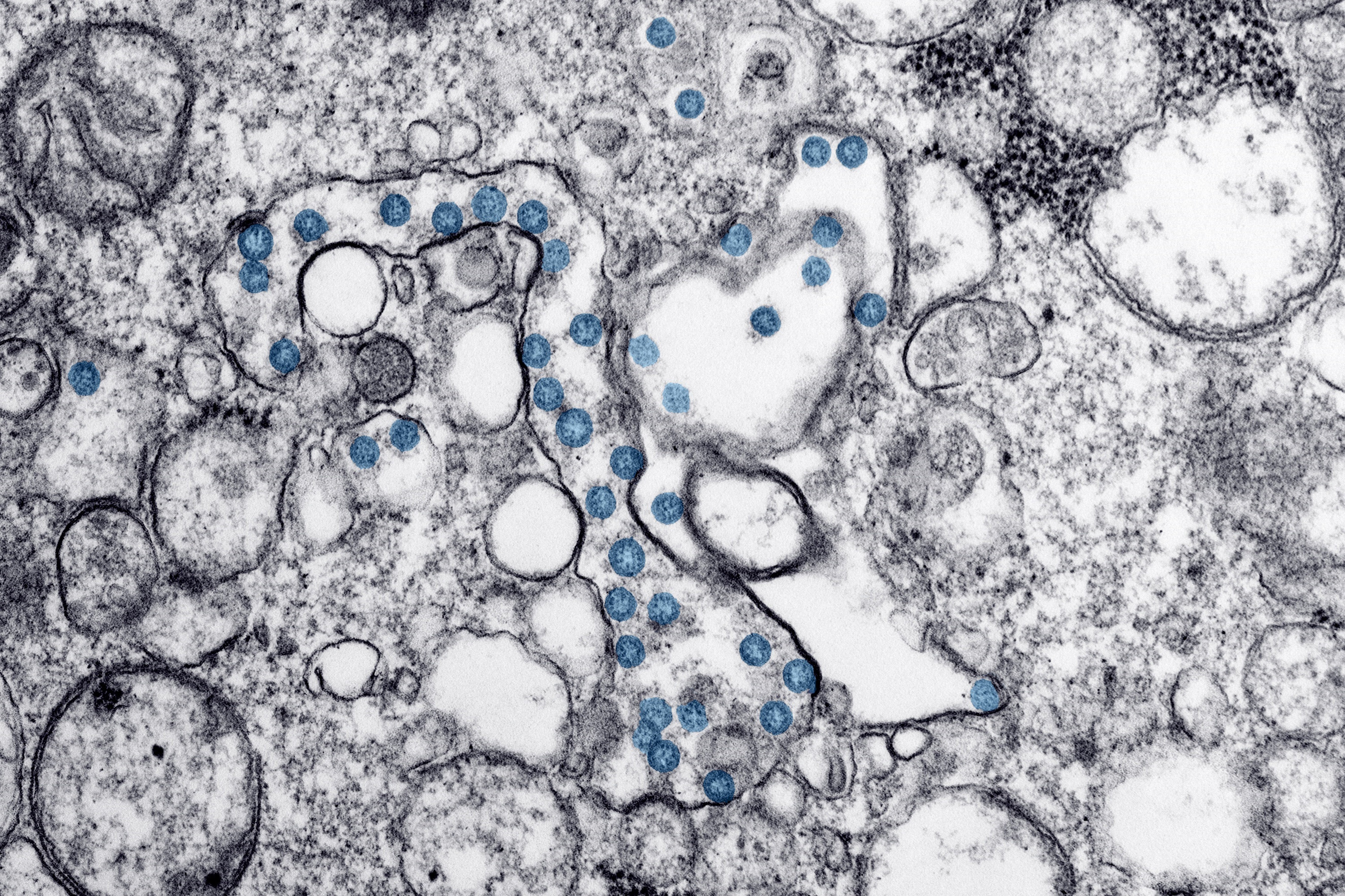 A transmission electron microscope image of an isolate from the first US case of Covid-19, with viral particles in blue. Photo: Getty Images