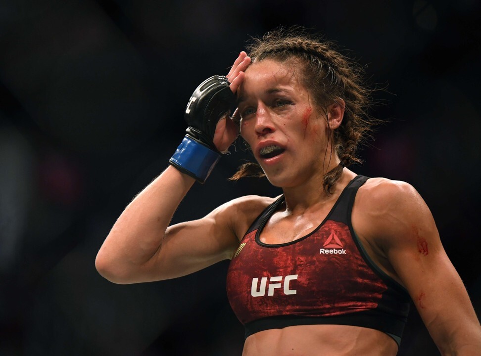Joanna Jedrzejczyk touches her forehead at the end of a round during her split decision loss to Zhang Weili. Photo: AFP