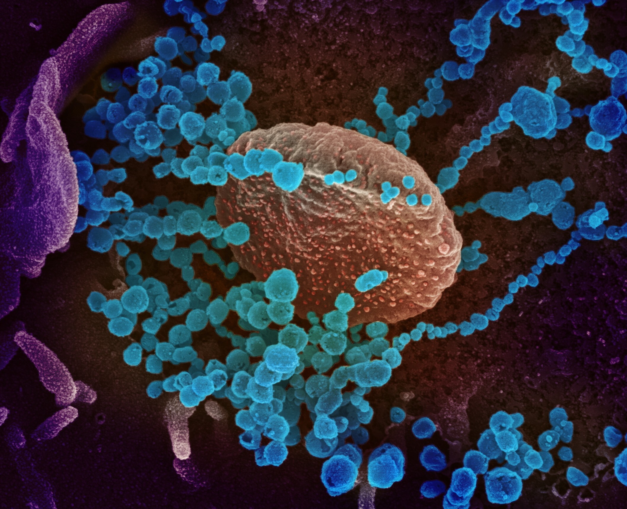 A scanning electron microscope image shows the new coronavirus (round blue objects) emerging from the surface of cells cultured in the lab. Image: NIH via EPA-EFE