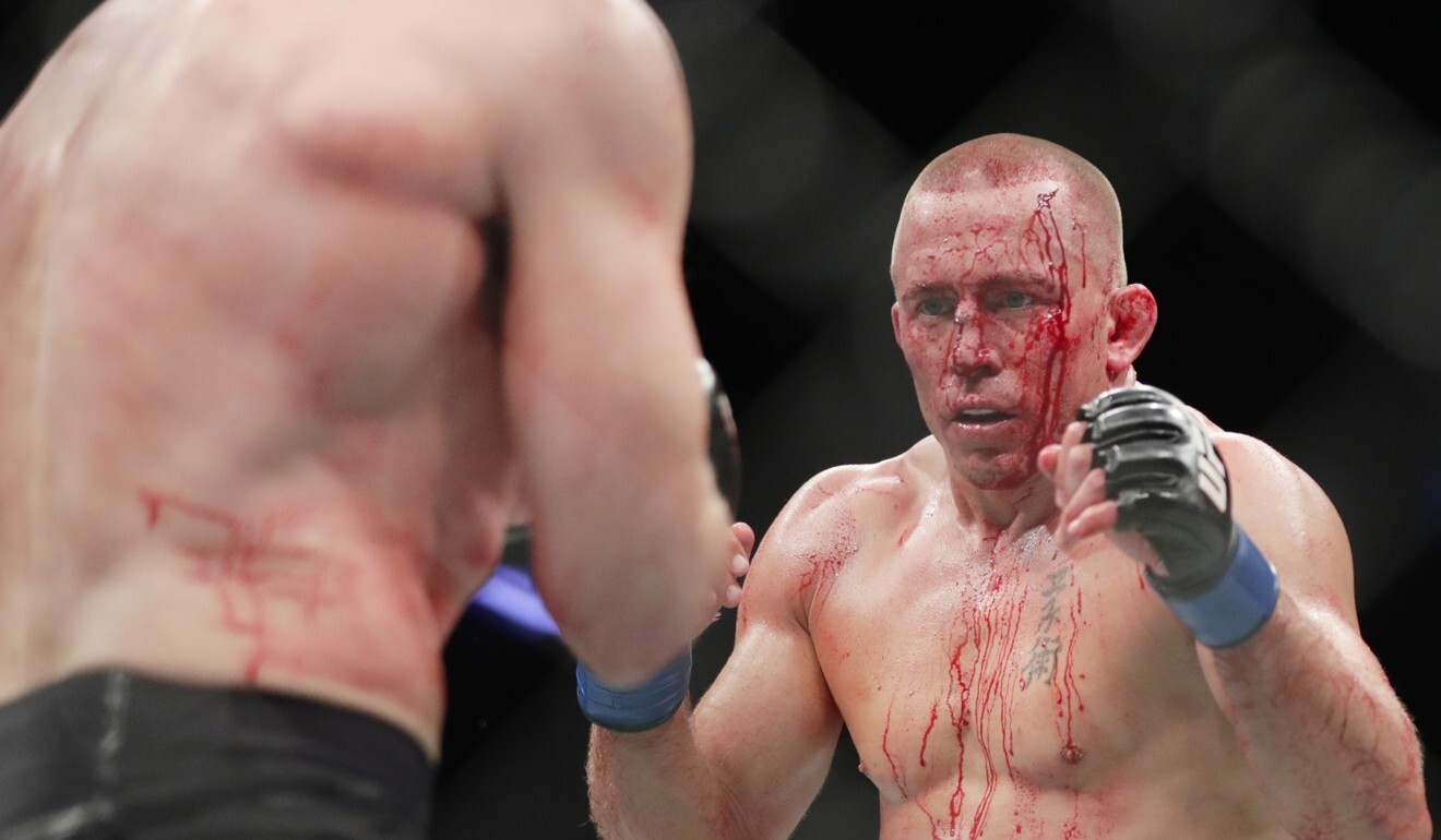 Georges St-Pierre was a true warrior, which meant humility came before revenge. Photo: AP
