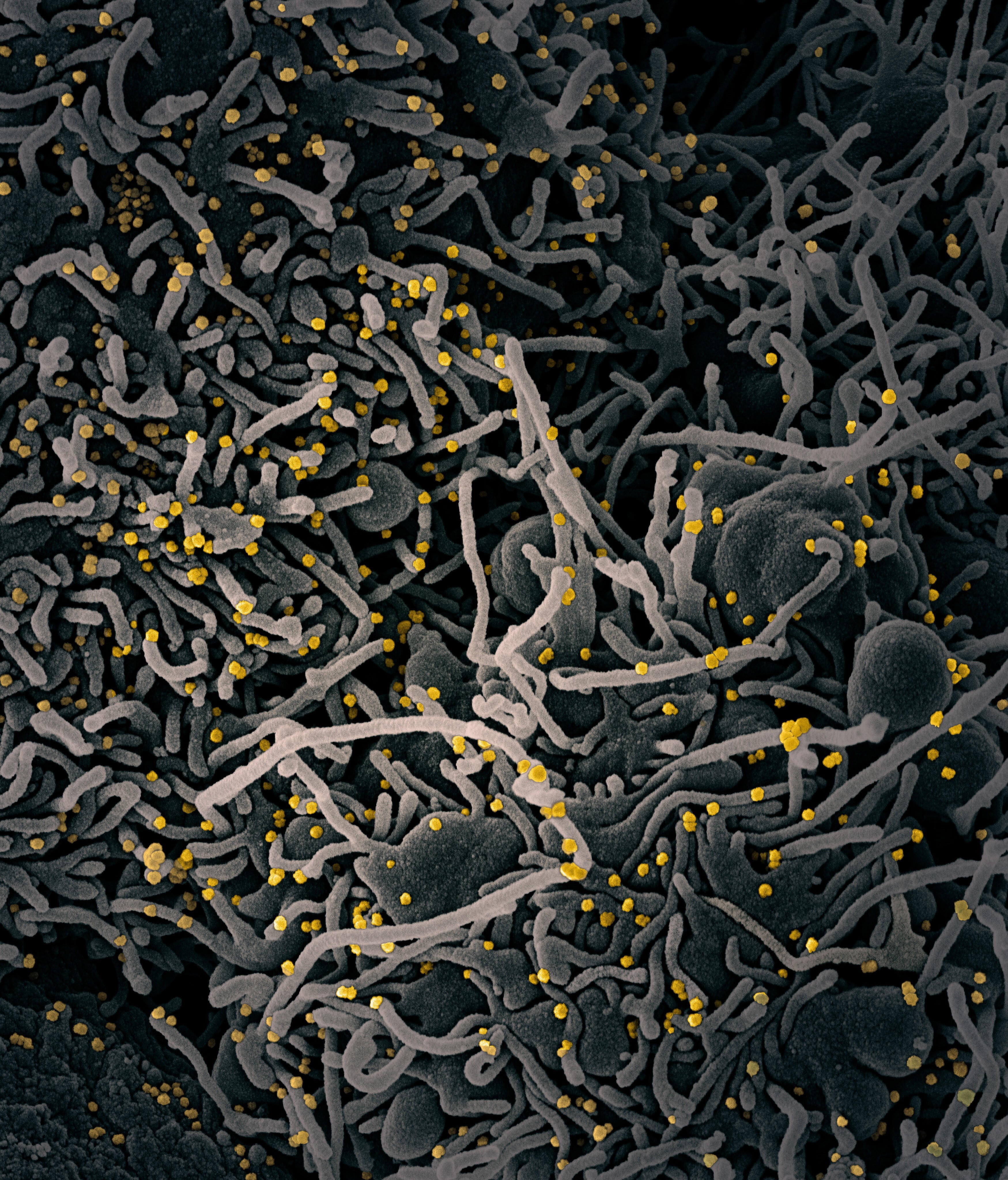 A scanning electron micrograph shows a cell with coronavirus particles in yellow. China has confirmed that some early samples were destroyed. Photo: EPA-EFE