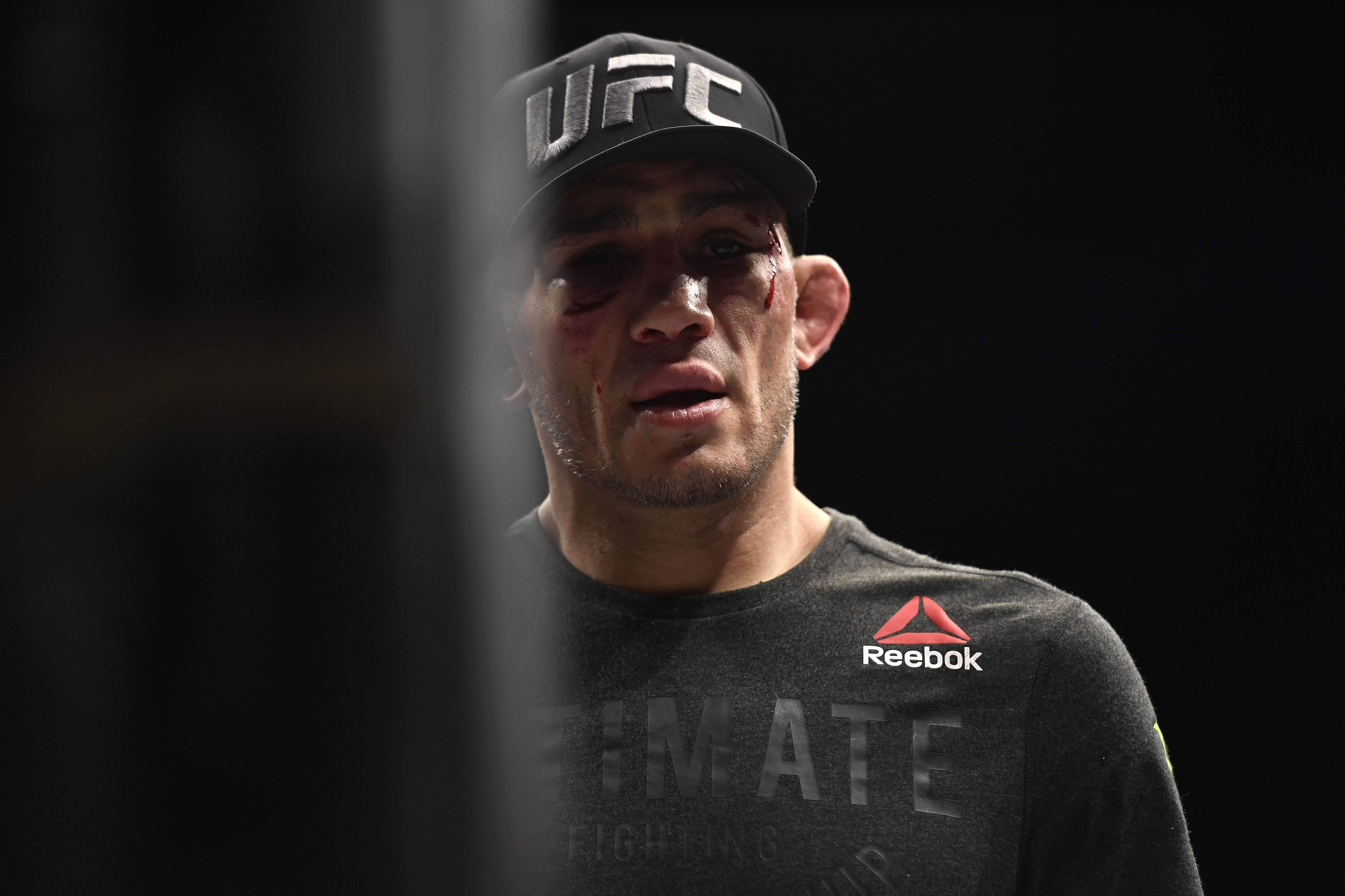 A bruised Tony Ferguson looks on after his devastating defeat by Justin Gaethje. Photo: AFP