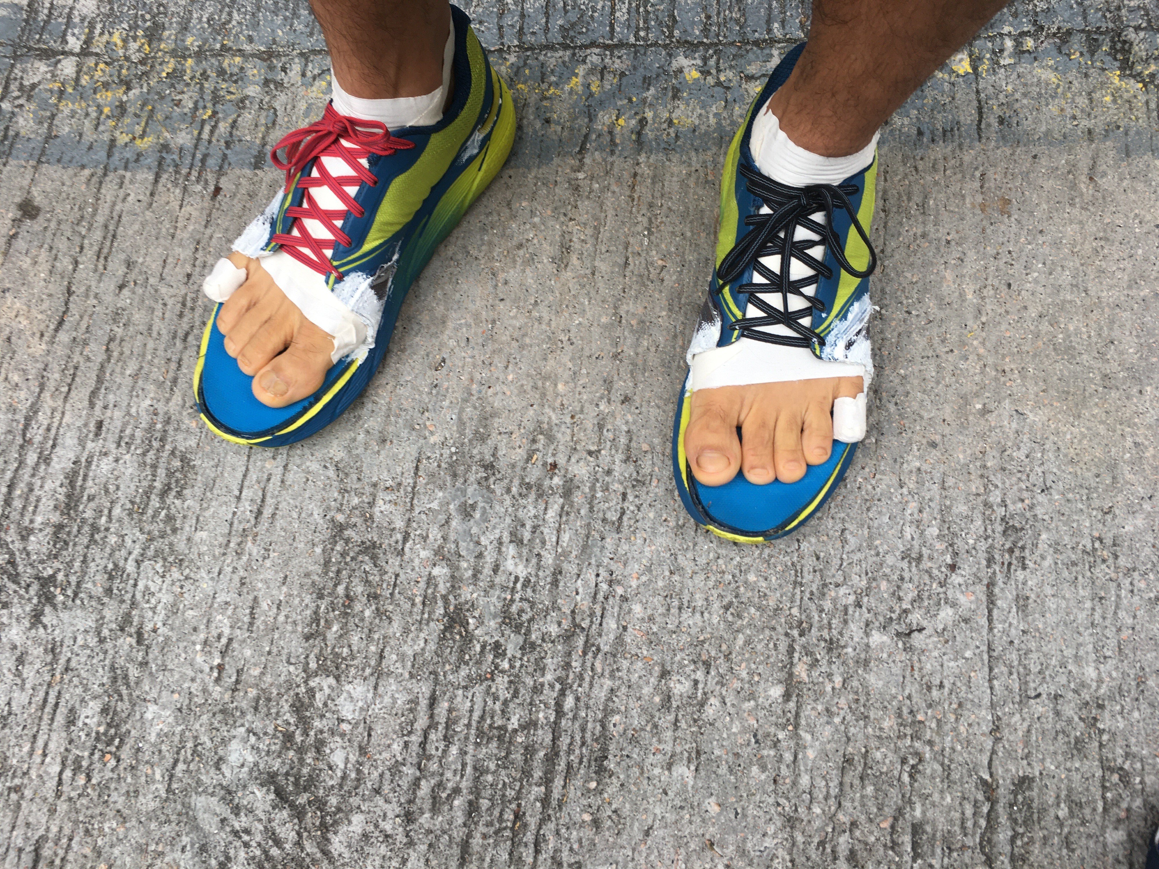 Phairat Varasin, a finisher of the 298km Hong Kong Four Trails Ultra Challenge, has modified his shoes for more toe room. Photo: Mark Agnew