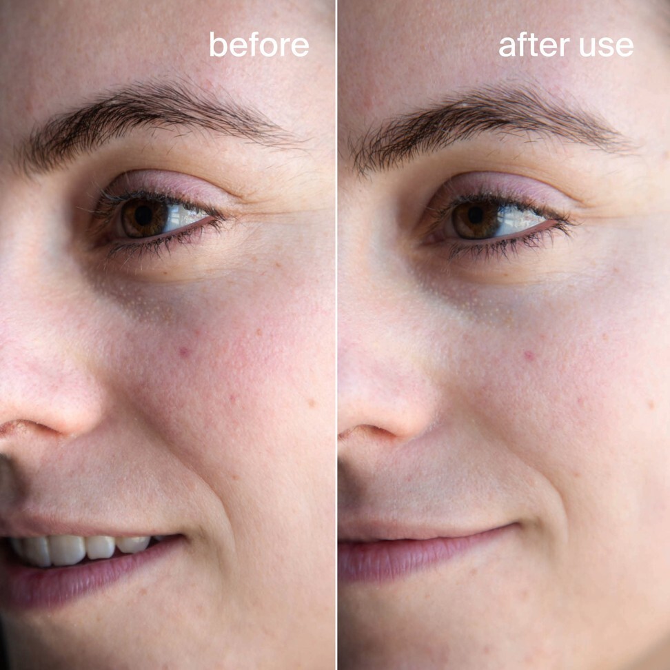 Before and after photos of a person using a Cocokind treatment.