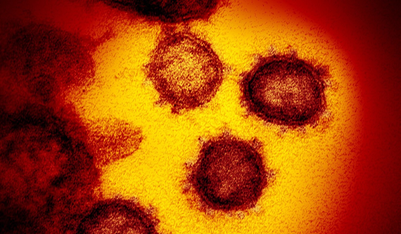The scientists said the coronavirus could be spread over several metres by tiny airborne droplets. Photo: AP