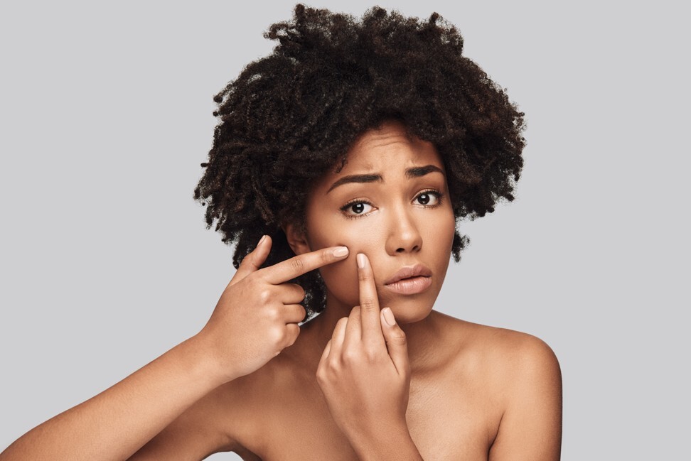 Adult acne and ‘maskne’ the myths, the facts, and the latest products