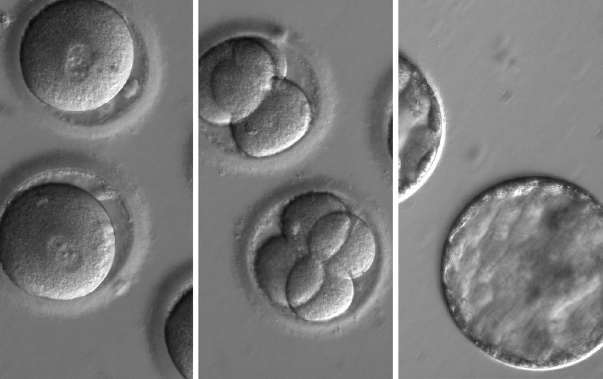 The gene-editing tool CRISPR targets a mutation in nuclear DNA. Photo EPA / OHSU