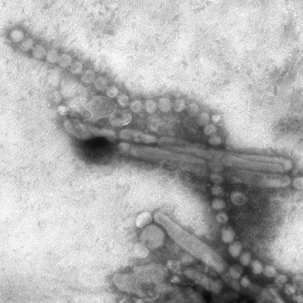 H7N9 virus as seen through an electron microscope. Photo: US Centres for Disease Control and Prevention