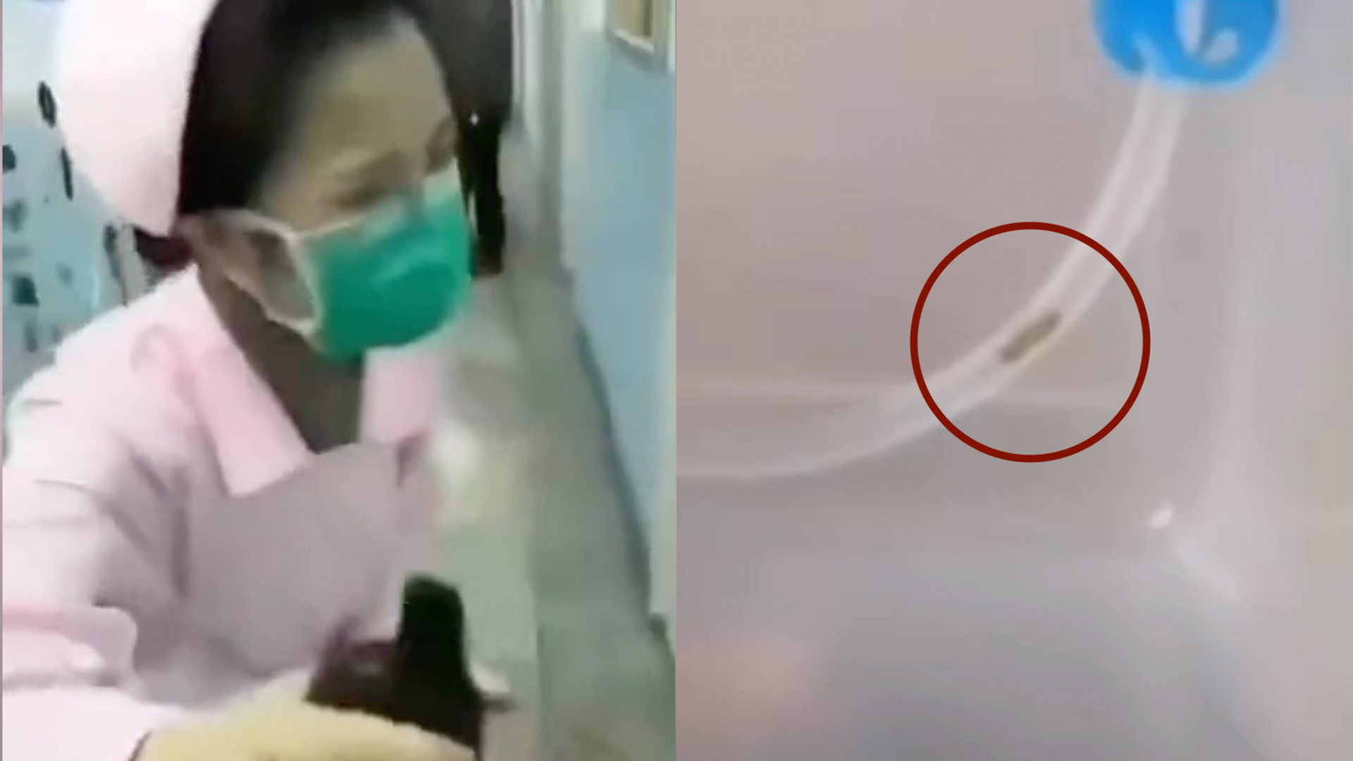 Father rages at nurse in China after finding ‘worm’ in son’s IV line