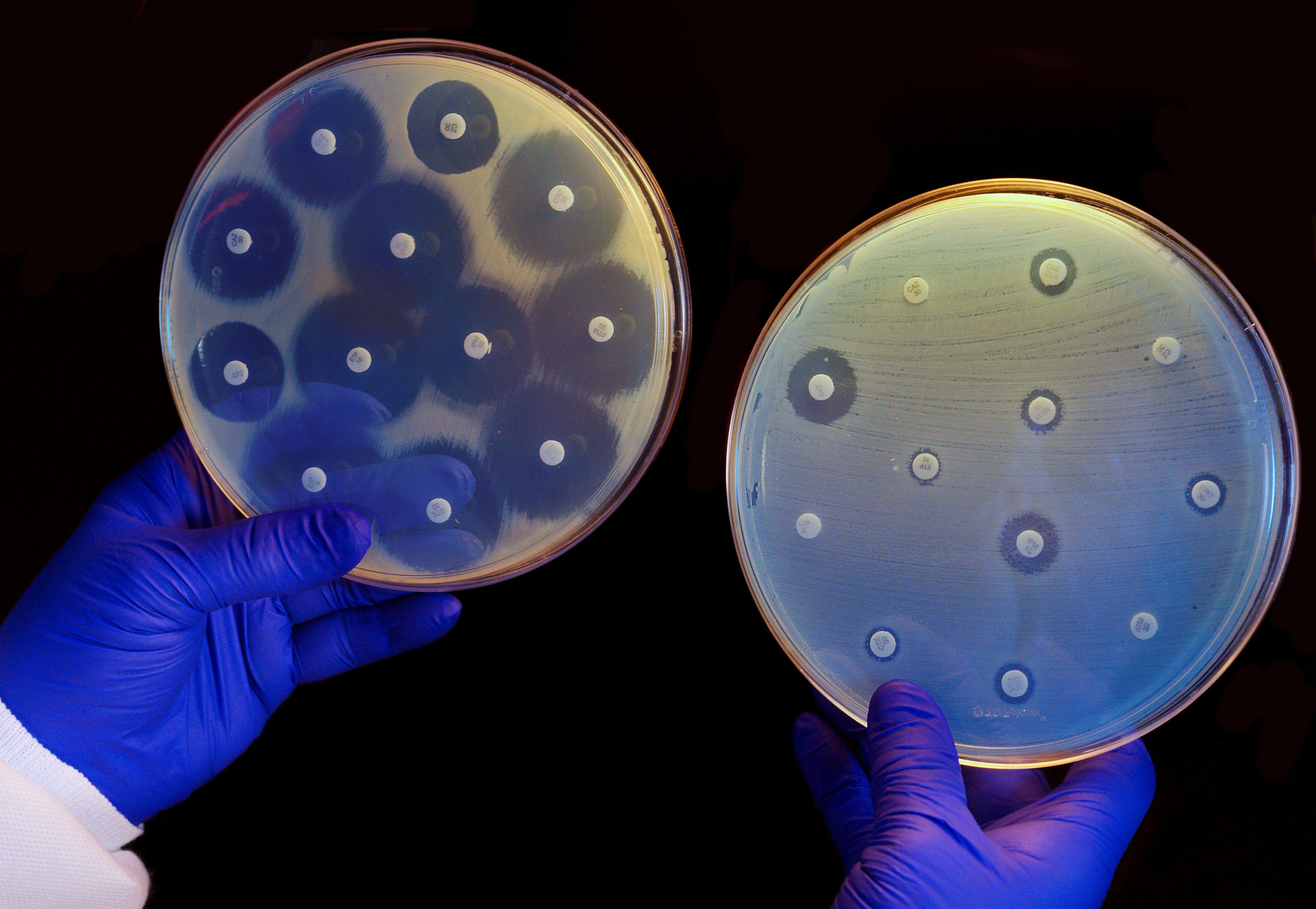 The plate on the left contains bacteria that are susceptible to antibiotics while the one on the right contains antibiotic-resistant bacteria. Picture: Alamy