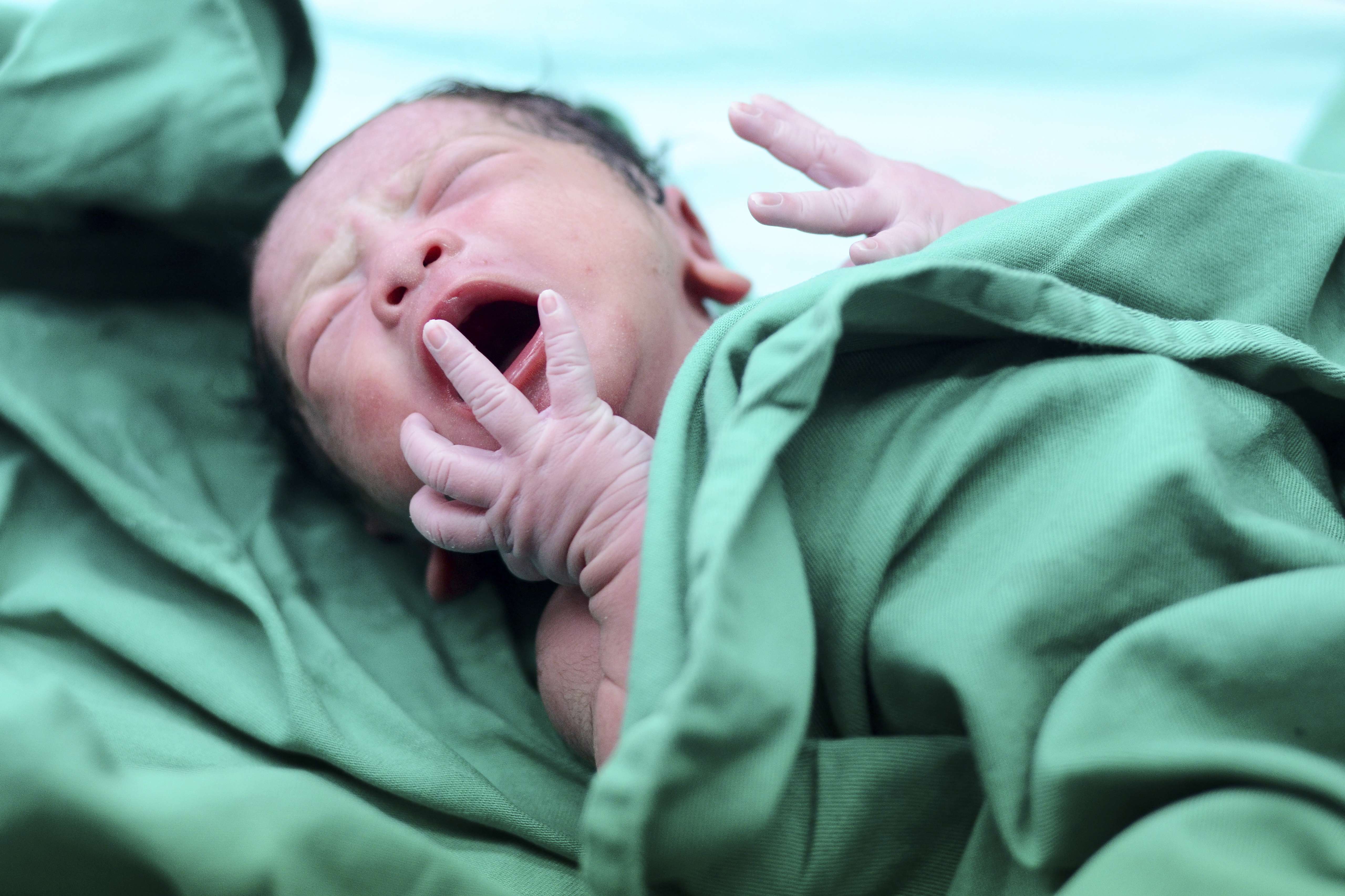 A new study has found the Chinese rate of births by caesarean section to be comparable to the US rate.