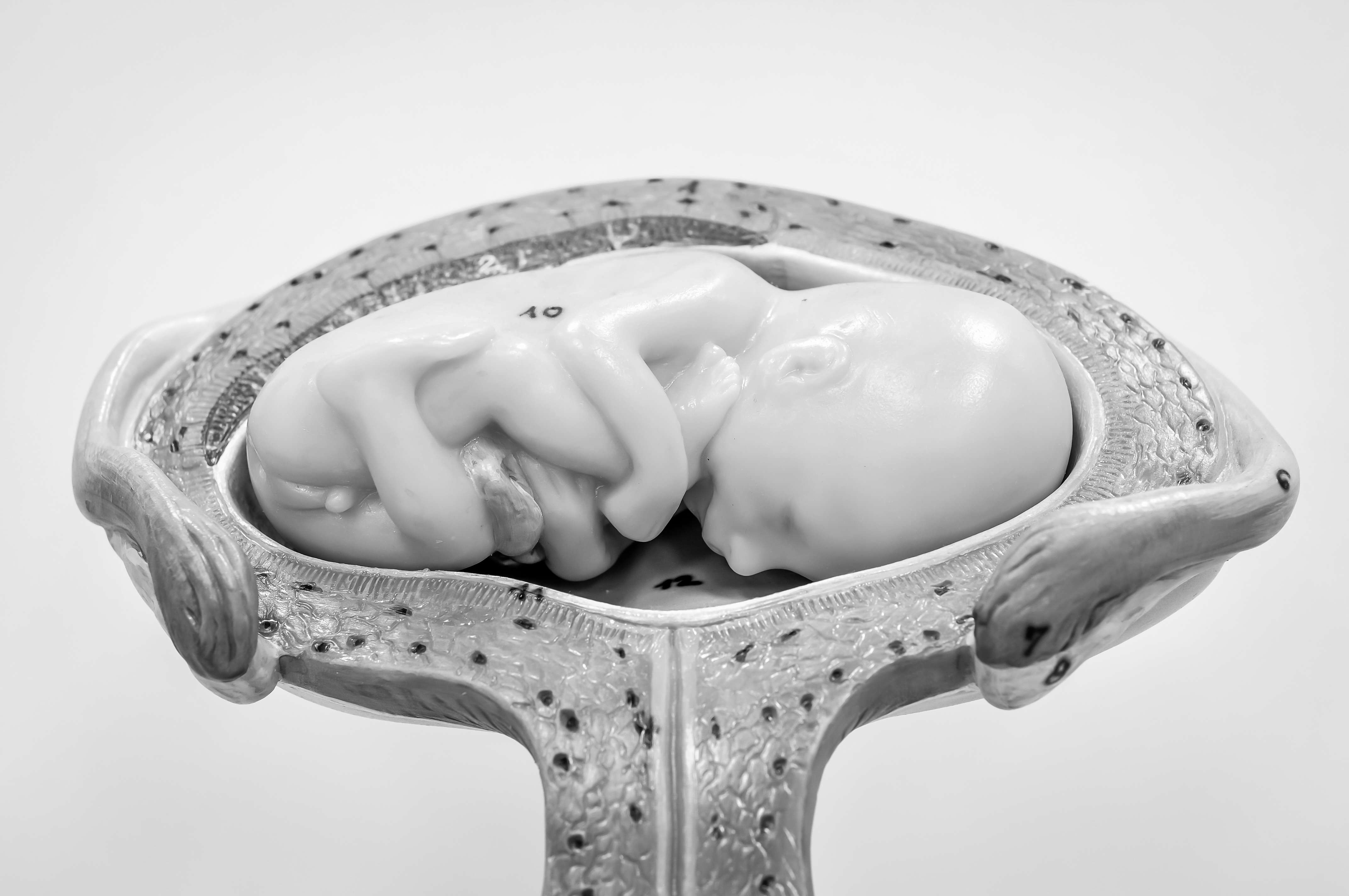 A model of a fetus and a placenta.