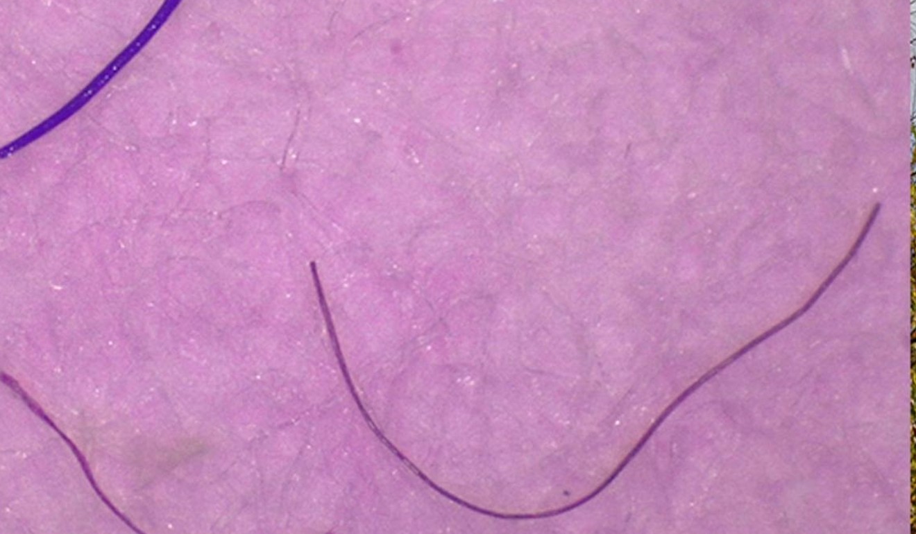 Onion Cell In Tap Water