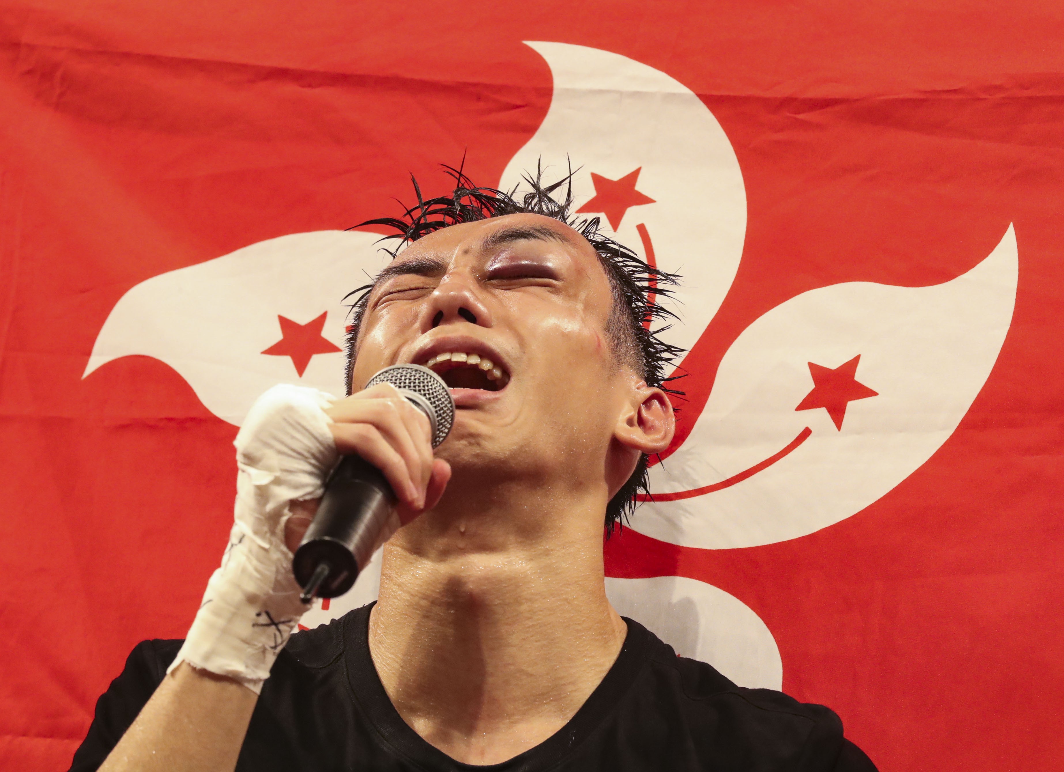 Hong Kong’s Rex Tso Sing-yu celebrates beating Kohei Kono in ‘Clash of Champions 3’ after suffering a grotesque eye injury. Photo: Edward Wong