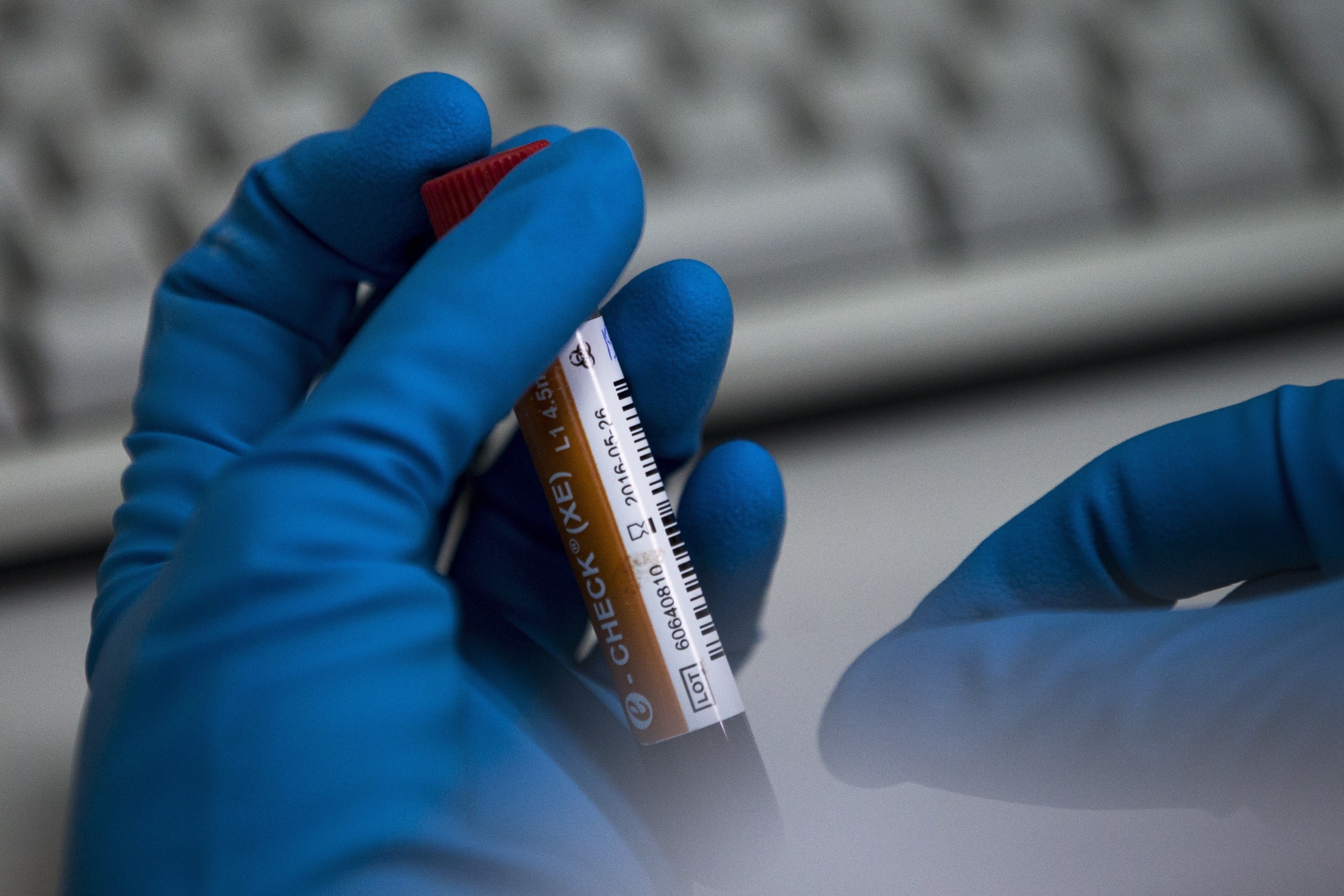 In this May 2016 file photo, an employee of Russia’s national drug-testing laboratory holds a vial in Moscow. Photo: AP