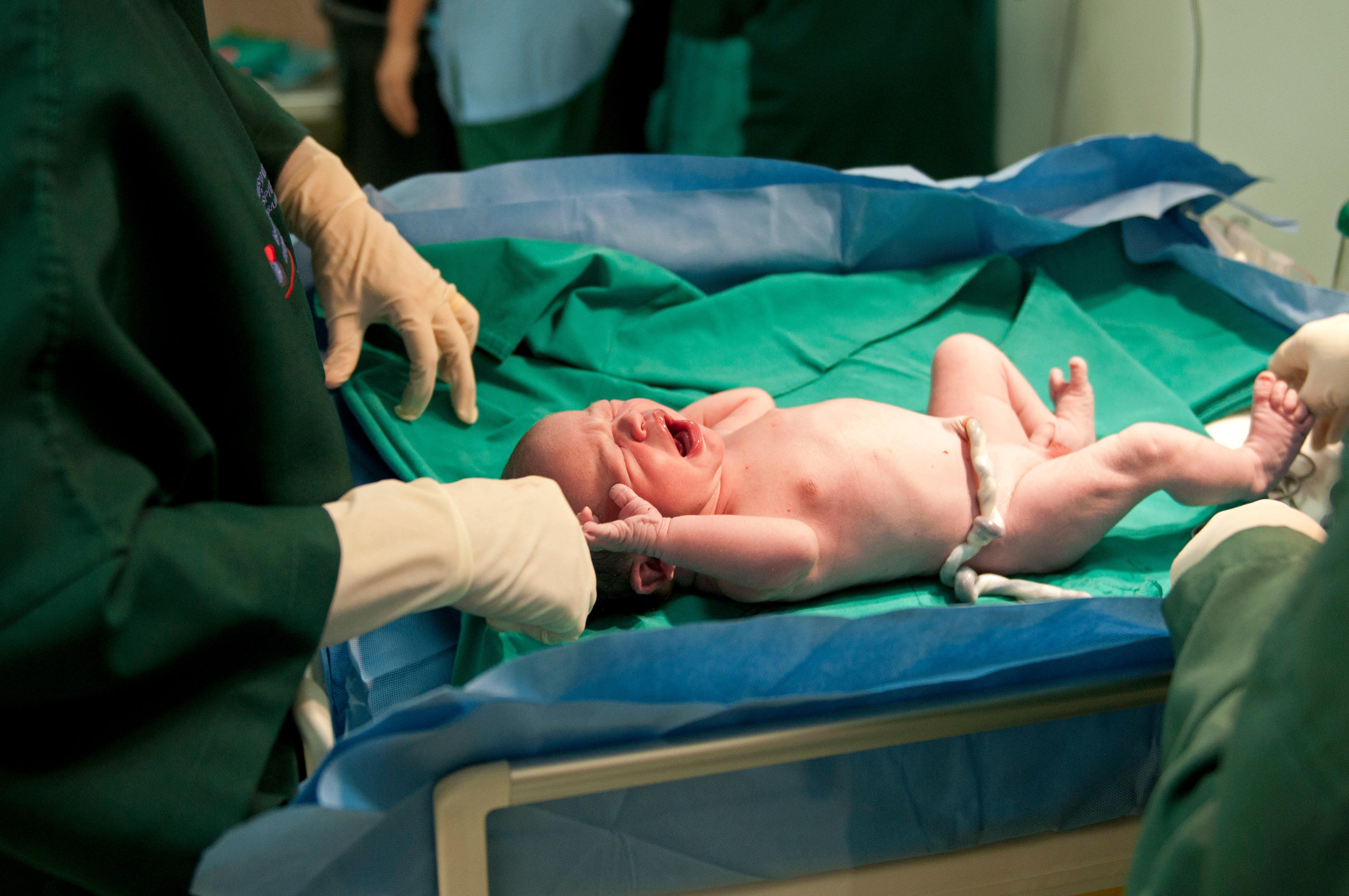 A newborn baby with the umbilical cord attached. Treatments derived from cord blood are booming – but unproven. Photo: Alamy