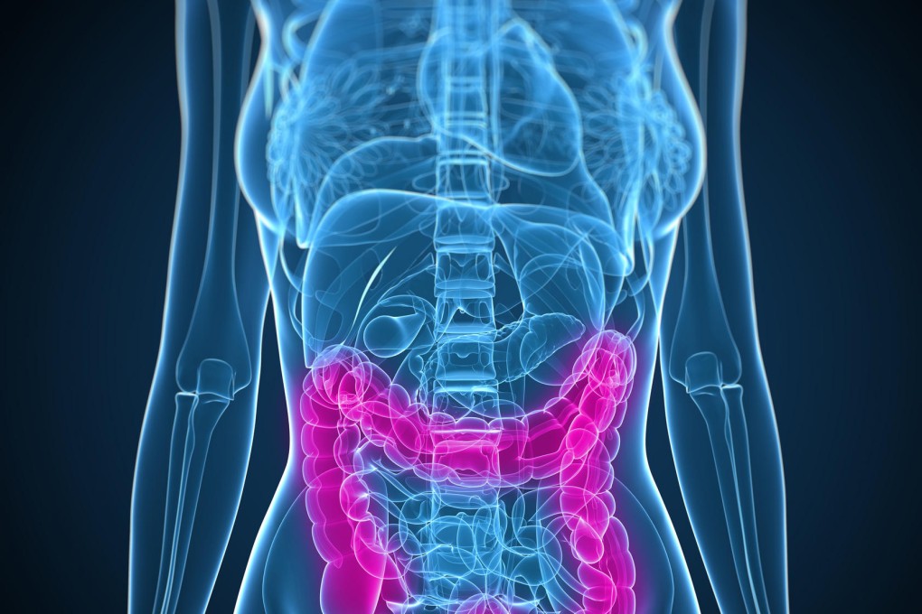 Colonics are popular, but practitioners' claims are not backed up by scientific research.Photo: Science Photo Library