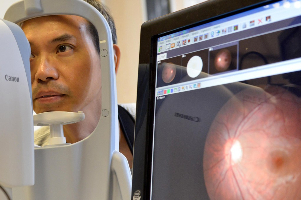 The retinal image analysis system. Photo: Thomas Yau