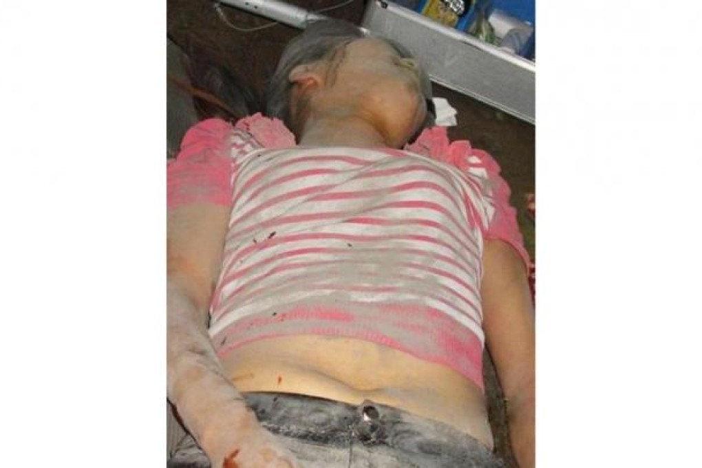 Peng Shuhua was hurt during a row over illegally grabbed land.