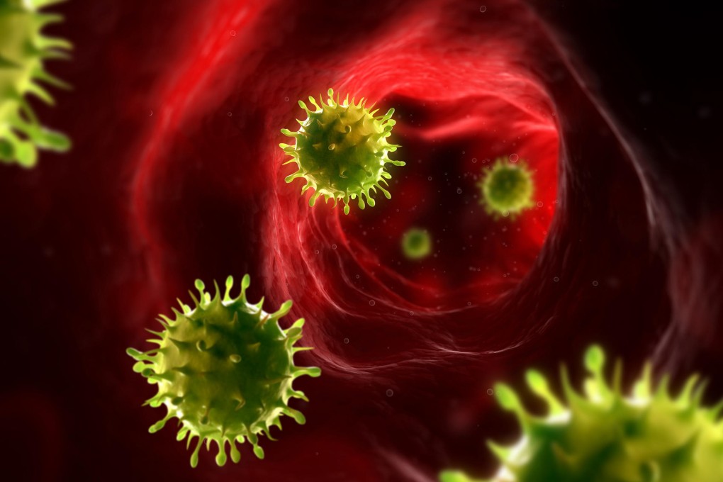 Sepsis is often misdiagnosed.Photo: Sciepro