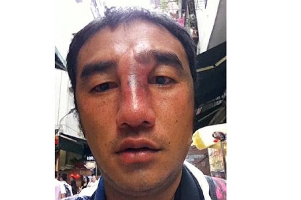 SCMP photographer Felix Wong is injured by Shenzhen police while covering the anti-Japan protests. Photo: Felix Wong