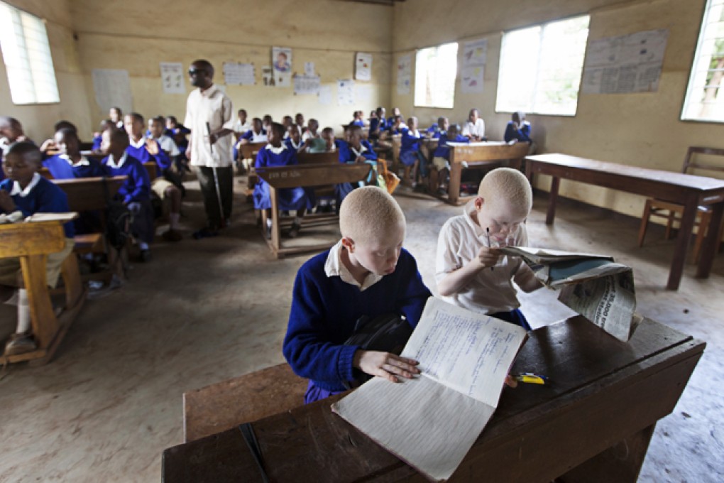 The Mwereni School in Moshi, in Tanzania's Kilimanjaro Region, caters to blind and albino students, whose desks are placed out of direct sunlight and close to the blackboard.