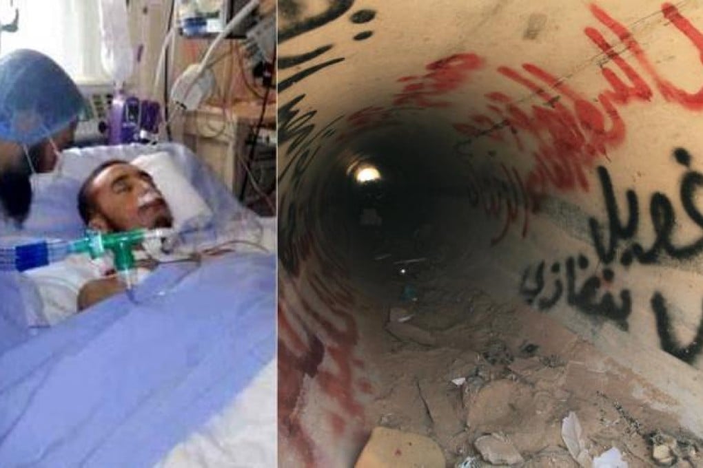 Shaban is treated in a French hospital (left), less than a year after helping drag Gaddafi from a drainage pipe (right). Photos: Reuters, AP
