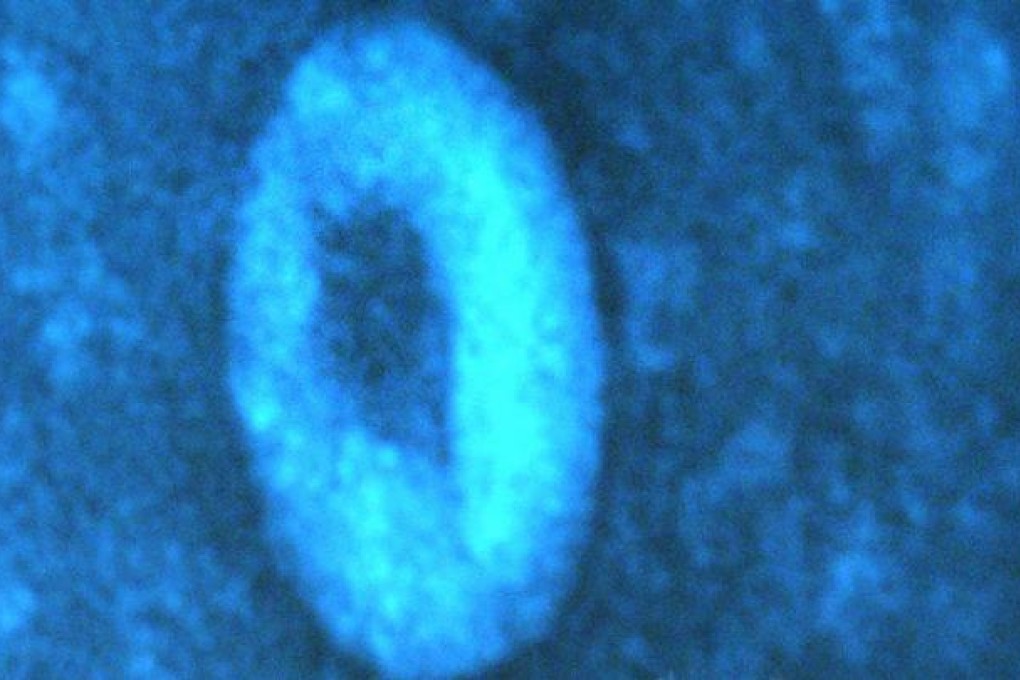 The Sars coronavirus. Photo: AP