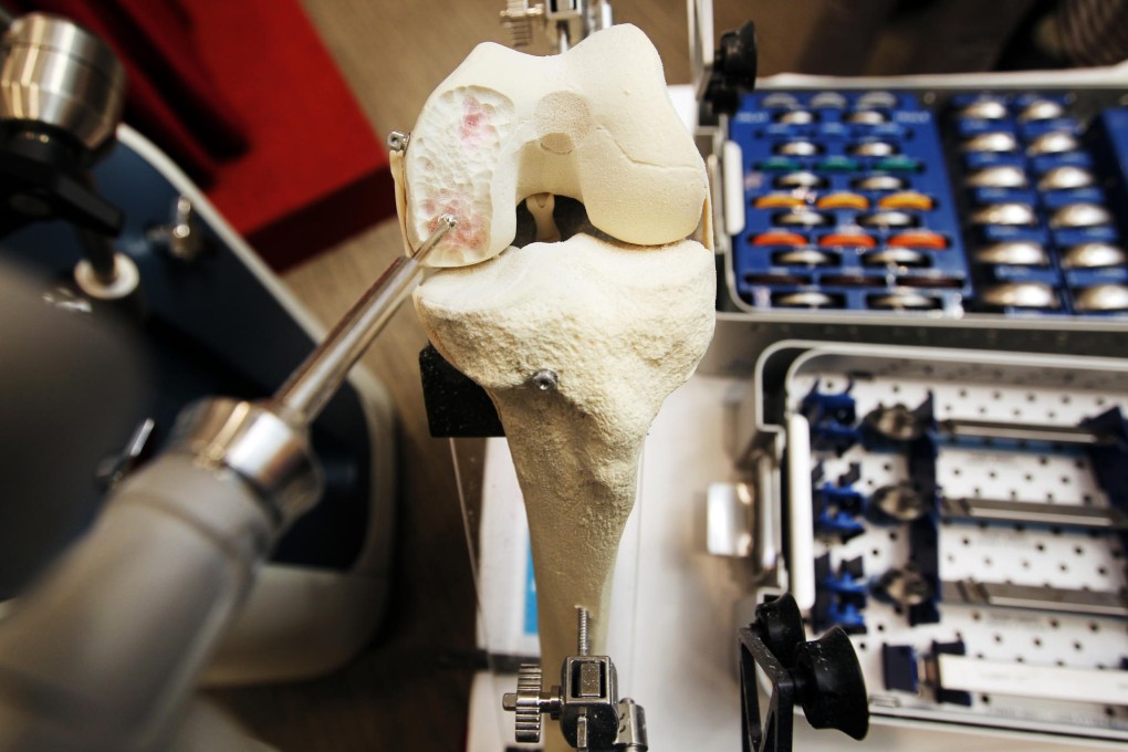 Asia's first robotic interactive orthopaedic system. Photos: Nora Tam, AFP