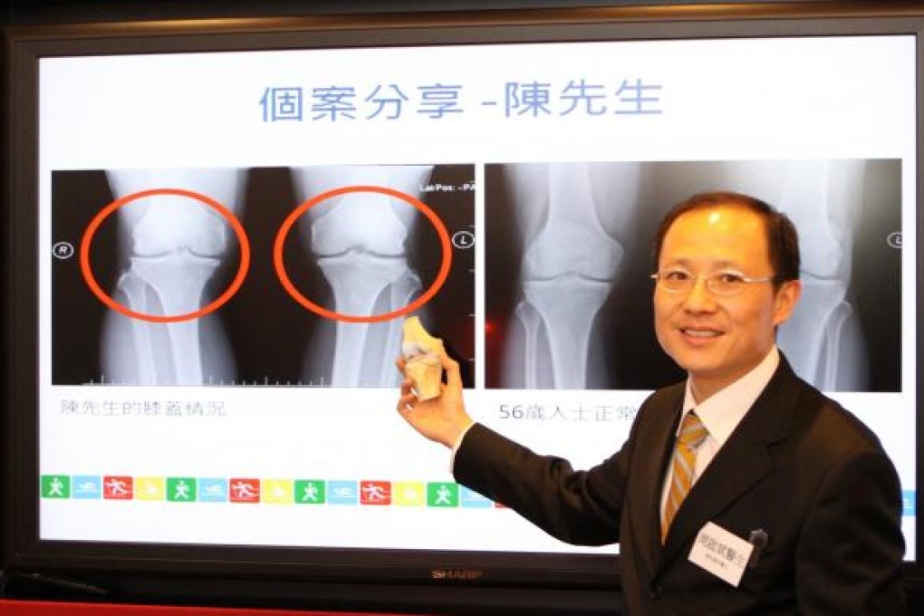 Orthopaedics Surgeon, Dr. Chow Kai-pun. Photo: SCMP Picture