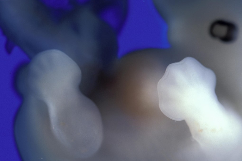 A human embryo at 40 days. Photo: Carolina Biological