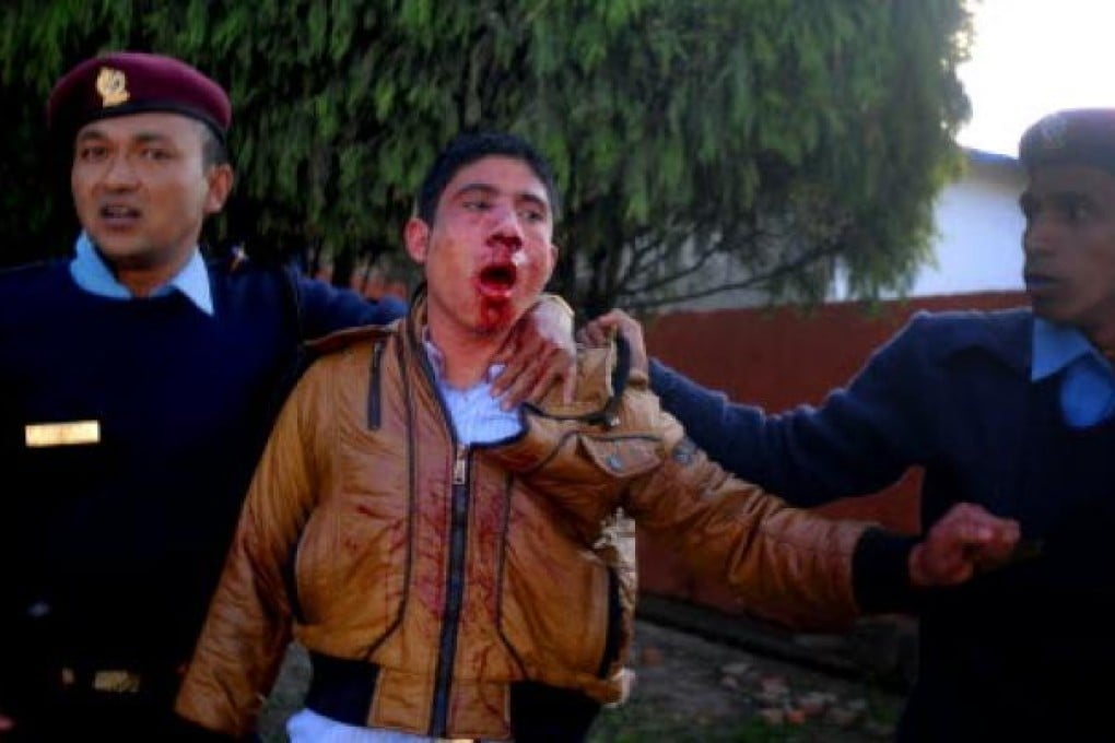 Nepalese police protect former Maoist supporter Padam Kuwar after he slapped the country's leader Pushpa Kamal Dahal in the face and was beaten up. Photo: AFP