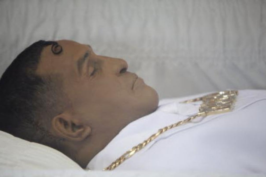 The body of former boxing champion Hector “Macho” Camacho lies in an open casket during his funeral in San Juan, Puerto Rico on Tuesday. Photo: AP