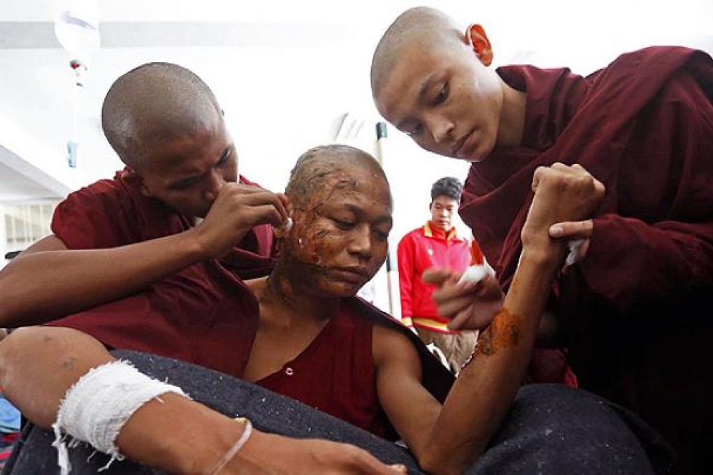 A Buddhist monk receives treatment after police fired water cannon and tear gas during a crackdown on villagers in Monywa, Myanmar, on Thursday. Photo: AFP