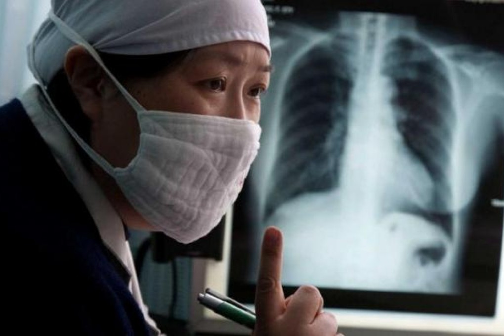 Tuberculosis is increasingly difficult to treat as the disease grows more resistant to drugs. Some 120,000 cases are diagnosed on the mainland each year. Photo: SCMP