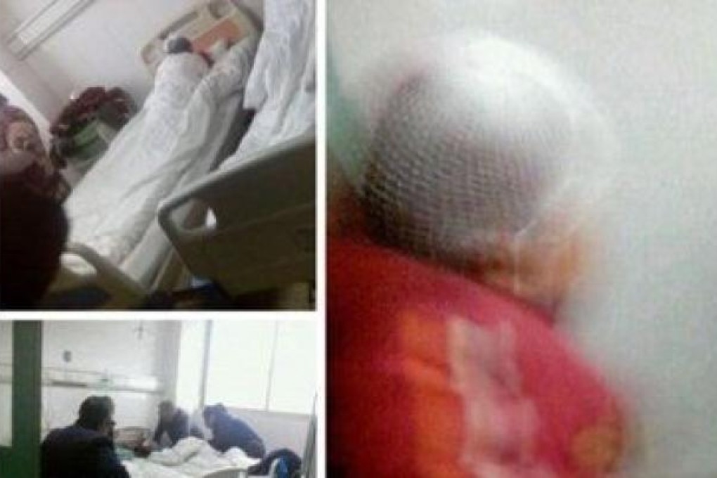 Victims of the attack were sent to a local hospital for treatment.The old woman in the picture was injured when protecting students, according to a source on Weibo. Photo: screenshot of Sina Weibo.