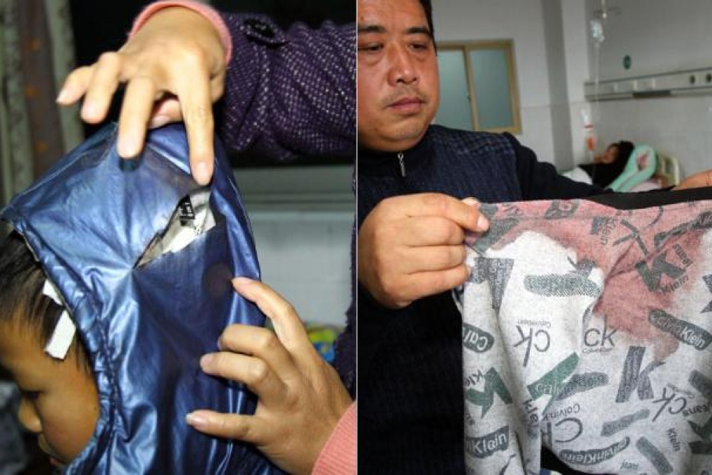 A mother shows a slashed coat hood and a father displays a bloody shirt in explaining how their sons were hurt in a knife attack. Photos: AFP