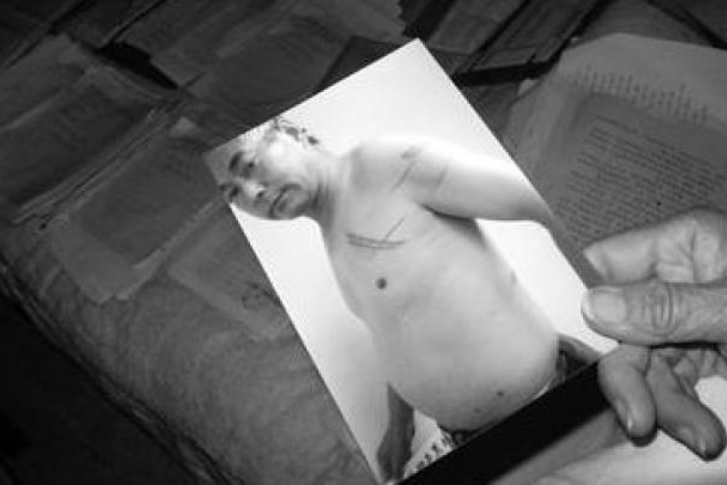 A picture of Wang showing his wounds. Photo: Sina.com