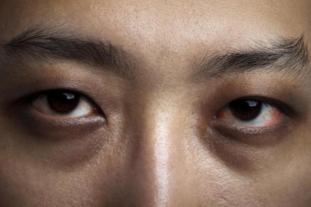 Breathing factor forces rethink on treating insomnia.