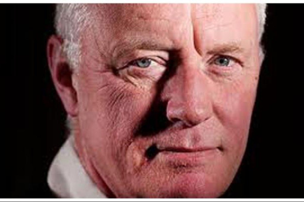 Barry Hearn