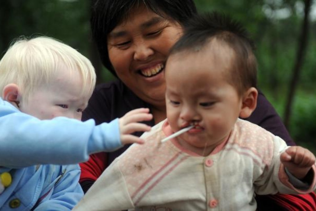 Yuan Lihai took in children with defects and problems, like albinism and cleft palates. Photo: China Foto Press