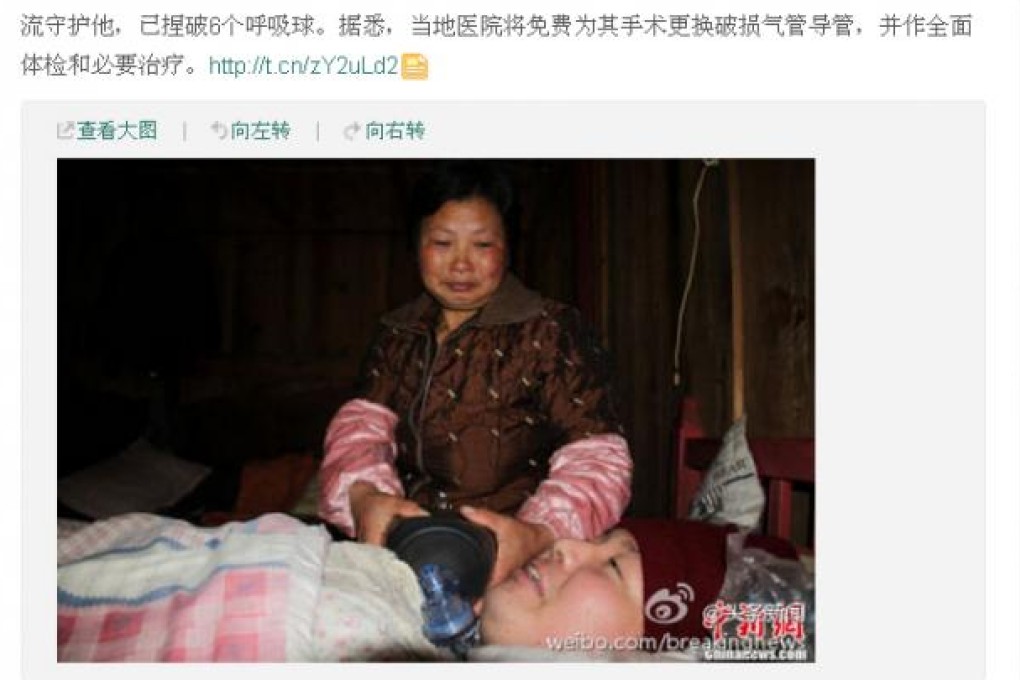 Wang Lanqin squeezes a pump to keep her son breathing, in a screenshot from weibo. Photo: SCMP Pictures