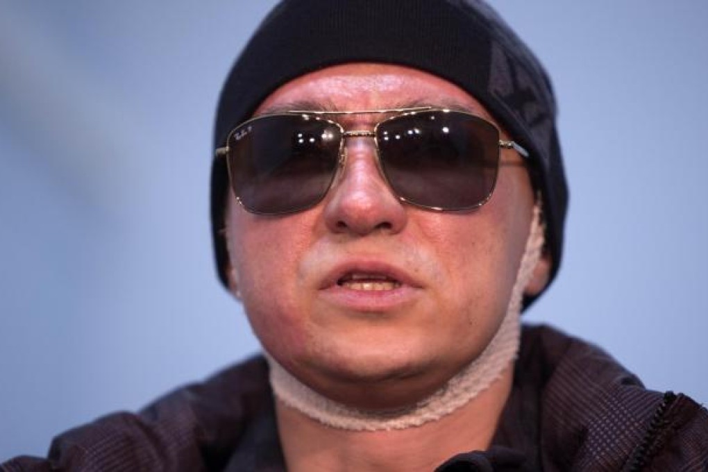 Sergei Filin had acid splashed on his face last month. Photo: AP