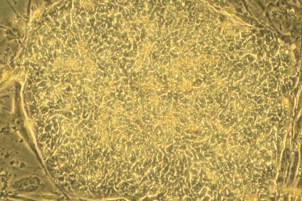 A colony of human embryonic stem cells, which can now be printed.
