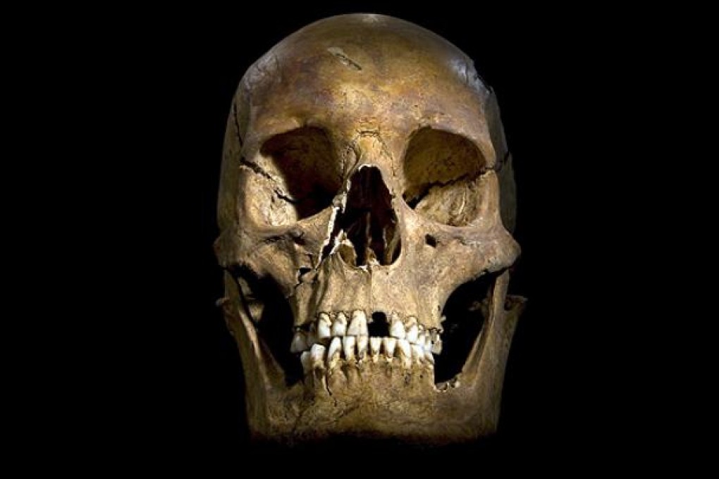 The skull of Richard III was unearthed from a British car park. Photo: Reuters