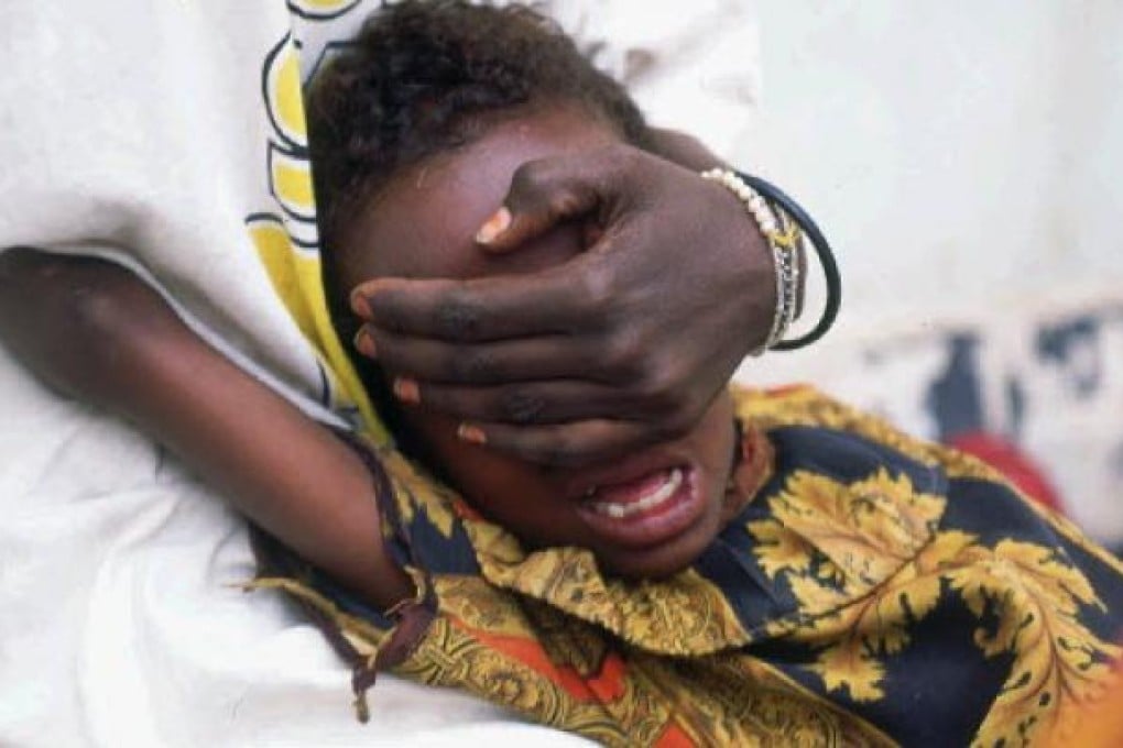 A six-year-old girl screams in pain while undergoing circumcision in Hargeisa in Somalia. Photo: AP