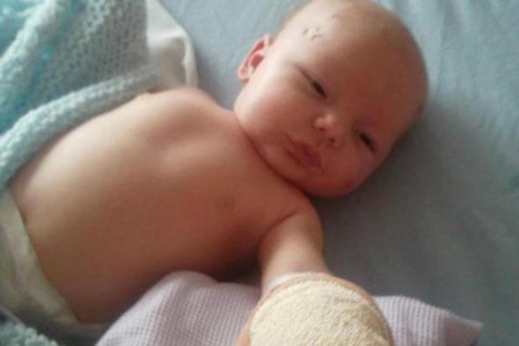 Denny Dolan in hospital after having his finger reattached.